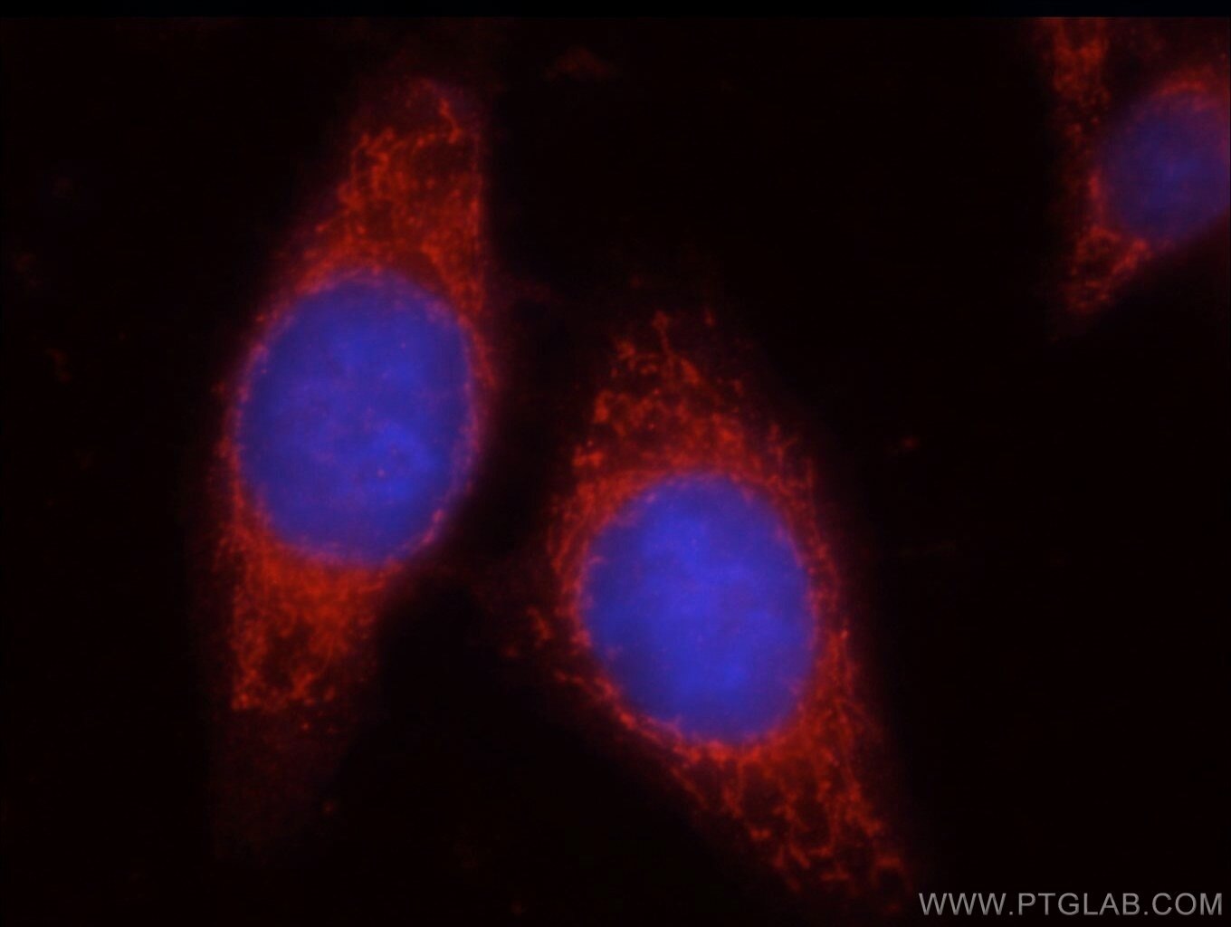 Immunofluorescence (IF) / fluorescent staining of HepG2 cells using Uroguanylin Polyclonal antibody (18113-1-AP)