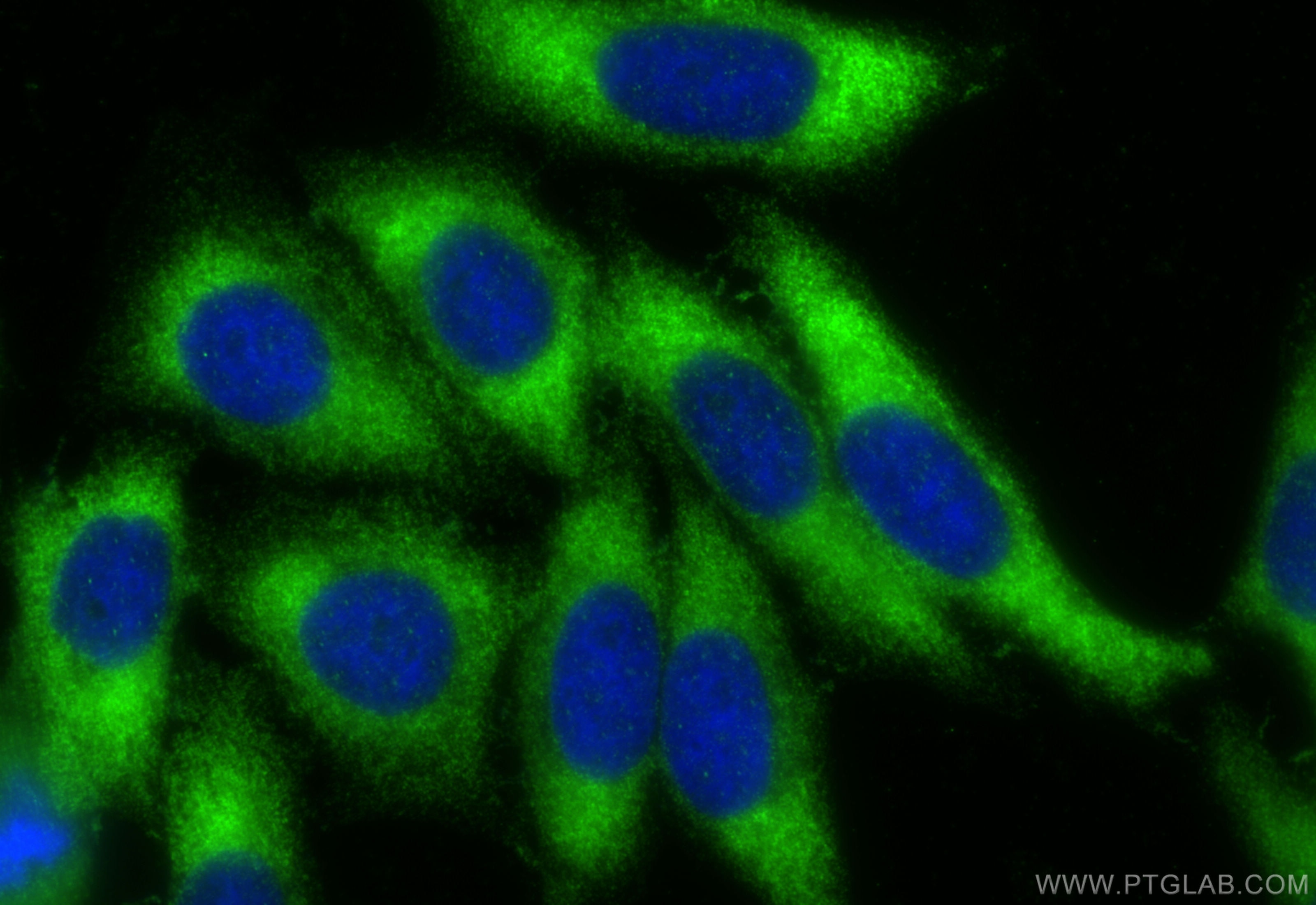 Immunofluorescence (IF) / fluorescent staining of HepG2 cells using Uroguanylin Polyclonal antibody (18113-1-AP)