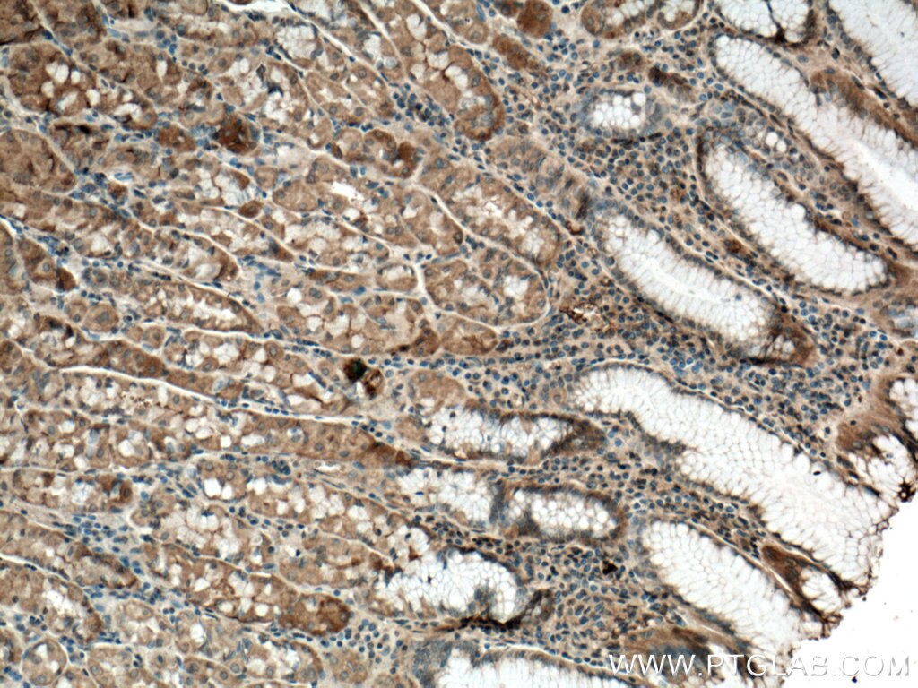 Immunohistochemistry (IHC) staining of human stomach tissue using Uroguanylin Polyclonal antibody (18113-1-AP)