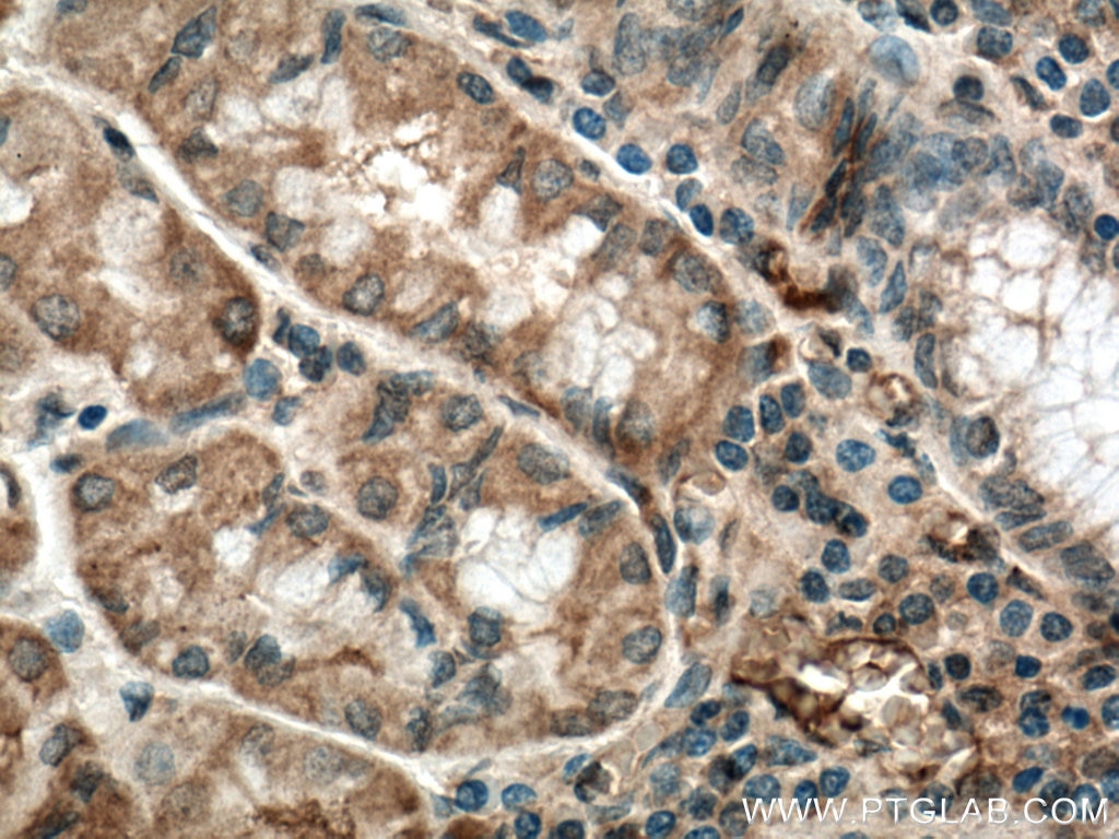 Immunohistochemistry (IHC) staining of human stomach tissue using Uroguanylin Polyclonal antibody (18113-1-AP)