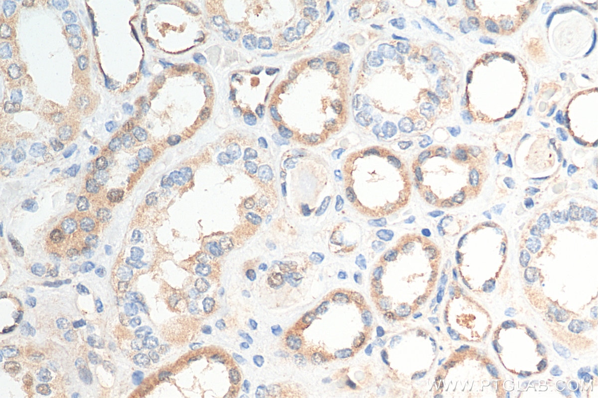 Immunohistochemistry (IHC) staining of human kidney tissue using Uroguanylin Polyclonal antibody (18113-1-AP)