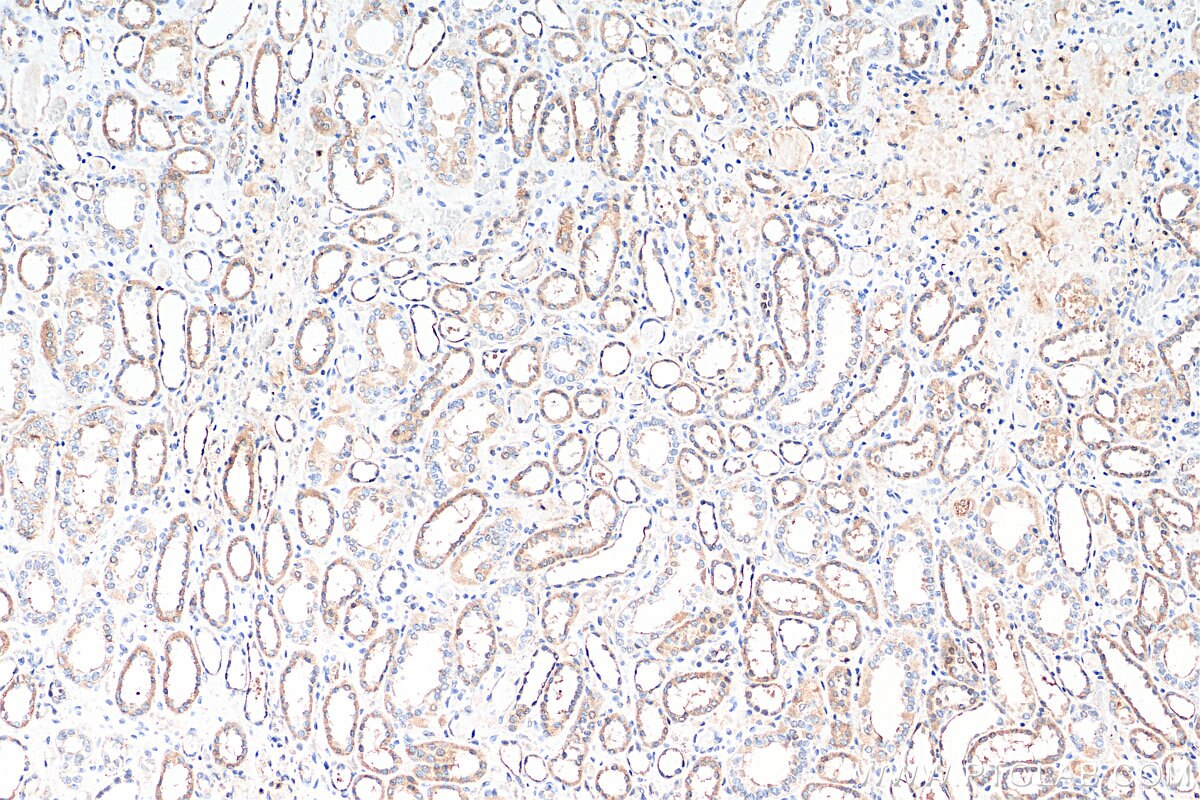 Immunohistochemistry (IHC) staining of human kidney tissue using Uroguanylin Polyclonal antibody (18113-1-AP)