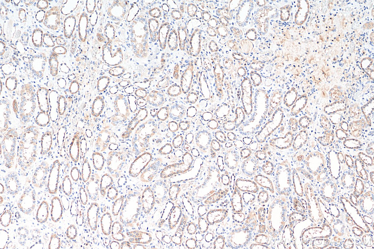Immunohistochemistry (IHC) staining of human kidney tissue using Uroguanylin Polyclonal antibody (18113-1-AP)