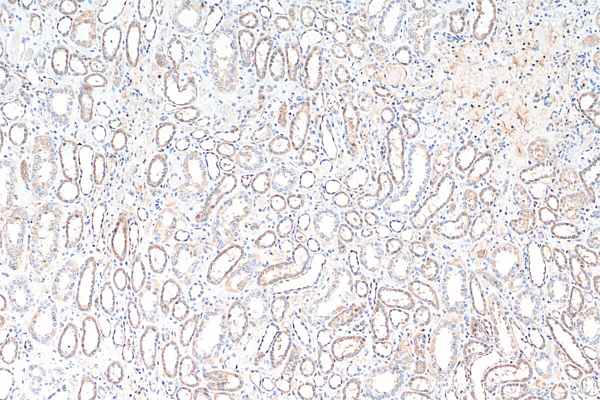 IHC staining of human kidney using 18113-1-AP