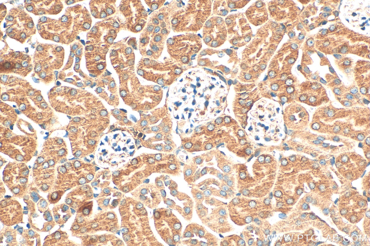 Immunohistochemistry (IHC) staining of mouse kidney tissue using Uroguanylin Polyclonal antibody (18113-1-AP)