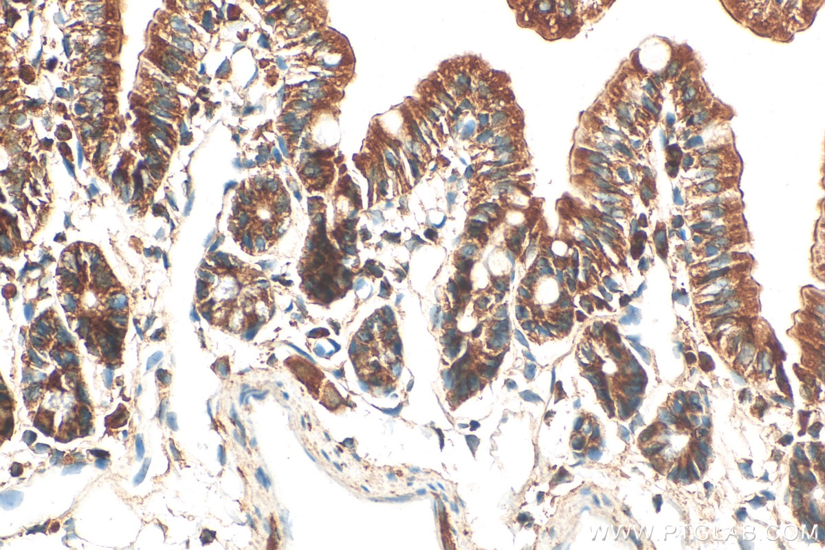 Immunohistochemistry (IHC) staining of mouse small intestine tissue using Uroguanylin Polyclonal antibody (18113-1-AP)