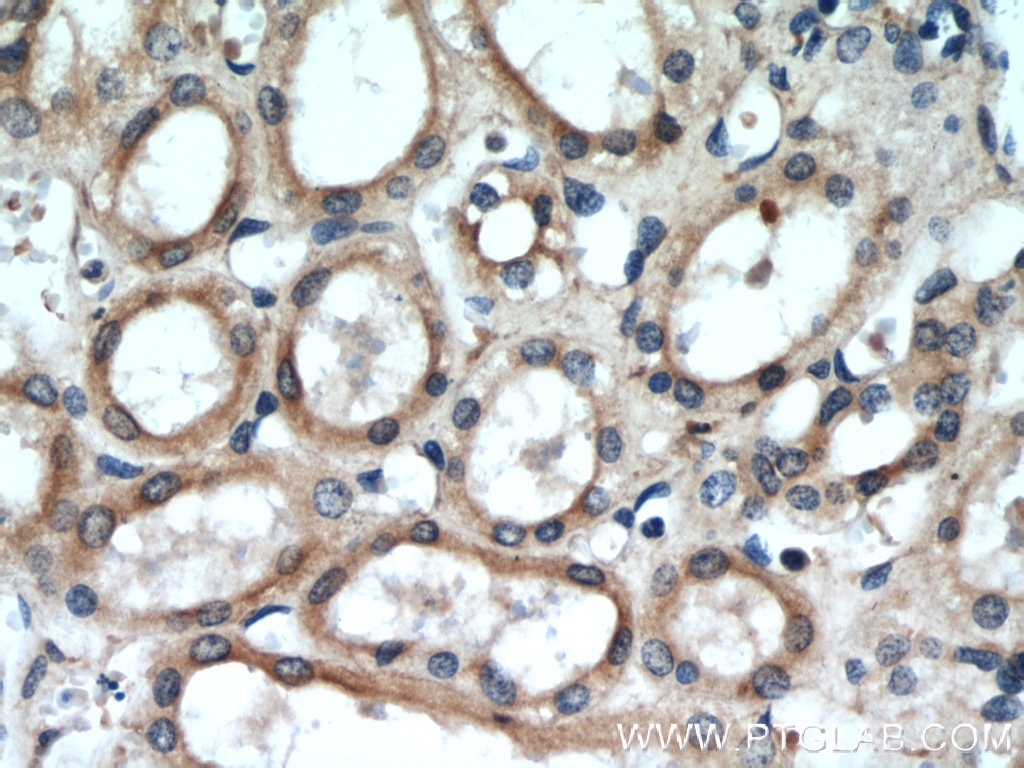 Immunohistochemistry (IHC) staining of human kidney tissue using Uroguanylin Polyclonal antibody (18113-1-AP)