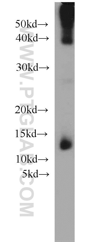 Western Blot (WB) analysis of mouse colon tissue using Uroguanylin Polyclonal antibody (18113-1-AP)