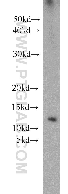 Western Blot (WB) analysis of mouse pancreas tissue using Uroguanylin Polyclonal antibody (18113-1-AP)