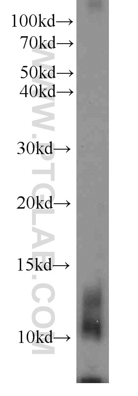 Western Blot (WB) analysis of rat pancreas tissue using Uroguanylin Polyclonal antibody (18113-1-AP)