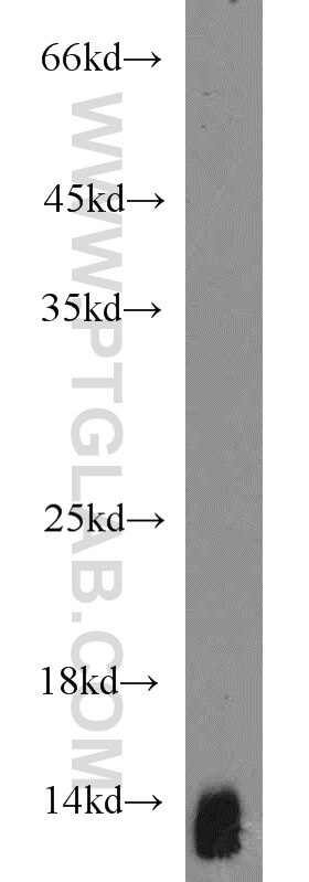 Western Blot (WB) analysis of mouse small intestine tissue using Uroguanylin Polyclonal antibody (18113-1-AP)