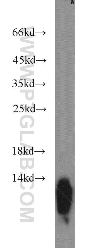 Western Blot (WB) analysis of mouse small intestine tissue using Uroguanylin Polyclonal antibody (18113-1-AP)