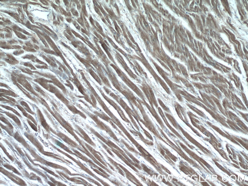 Immunohistochemistry (IHC) staining of human heart tissue using GUCY1A3 Polyclonal antibody (12605-1-AP)