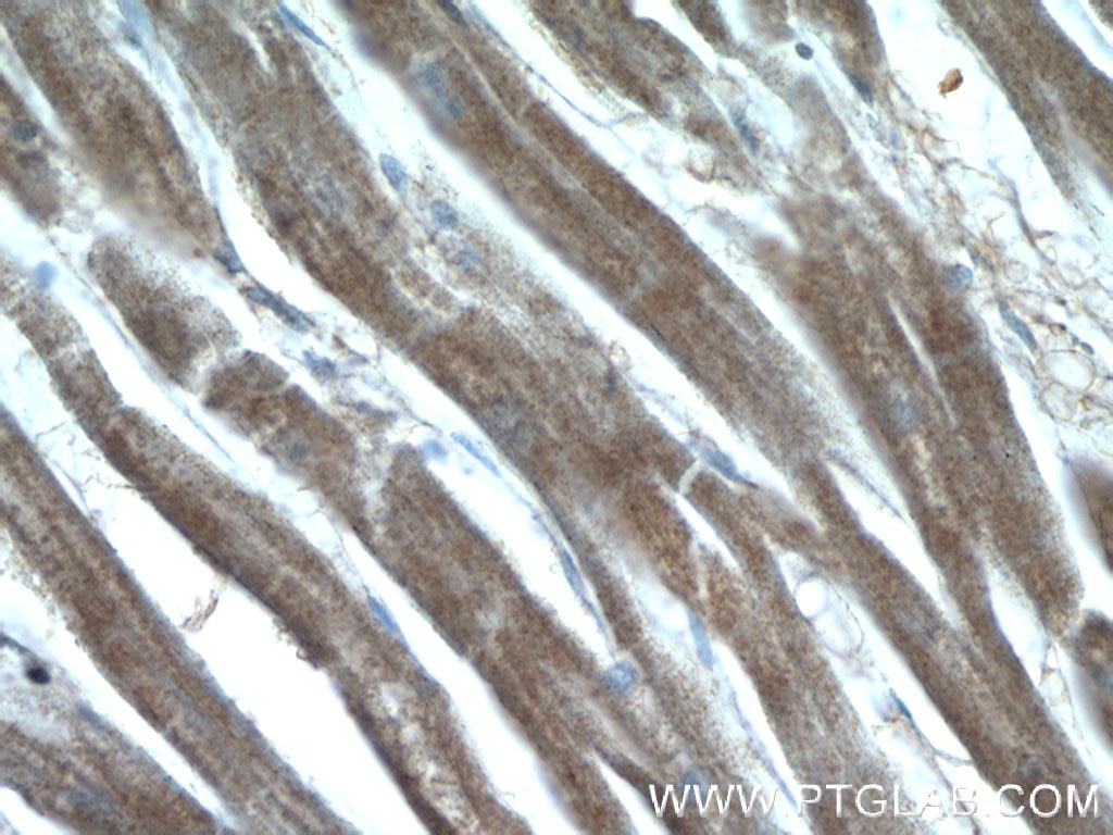 Immunohistochemistry (IHC) staining of human heart tissue using GUCY1A3 Polyclonal antibody (12605-1-AP)