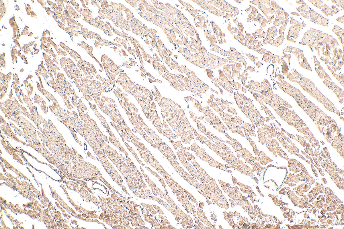 Immunohistochemical analysis of paraffin-embedded mouse heart tissue slide using 12605-1-AP (GUCY1A3 antibody) at dilution of 1:200 (under 10x lens). Heat mediated antigen retrieval with Tris-EDTA buffer (pH 9.0). Immunohistochemistry (IHC) staining of mouse heart tissue using GUCY1A3 Polyclonal antibody (12605-1-AP)