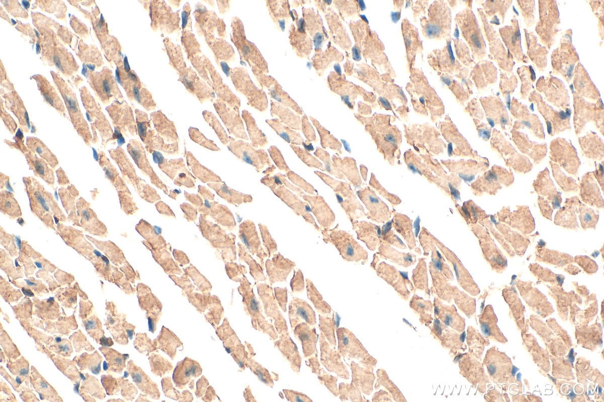 Immunohistochemical analysis of paraffin-embedded mouse heart tissue slide using 12605-1-AP (GUCY1A3 antibody) at dilution of 1:200 (under 40x lens). Heat mediated antigen retrieval with Tris-EDTA buffer (pH 9.0). Immunohistochemistry (IHC) staining of mouse heart tissue using GUCY1A3 Polyclonal antibody (12605-1-AP)