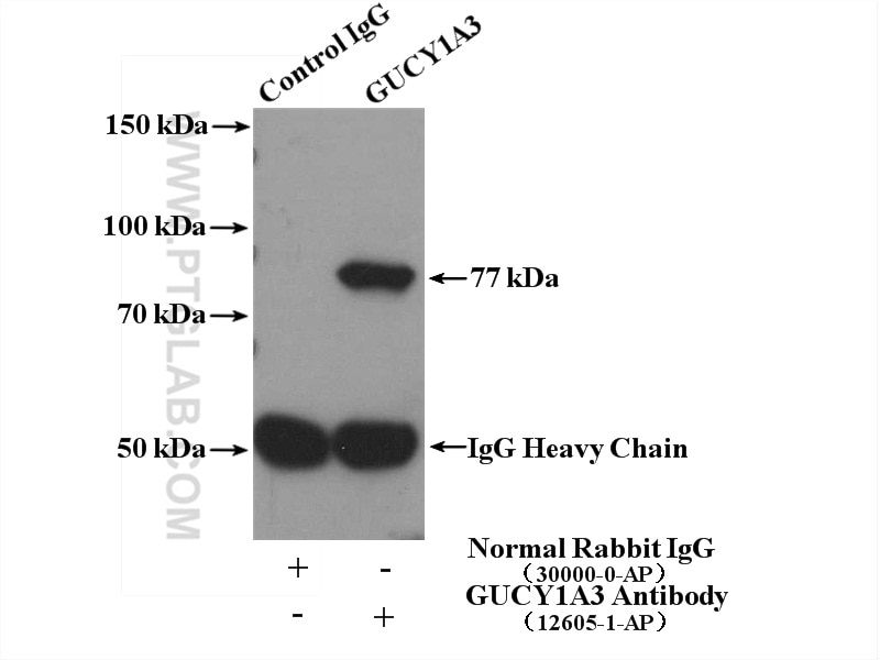 Immunoprecipitation (IP) experiment of mouse lung tissue using GUCY1A3 Polyclonal antibody (12605-1-AP)