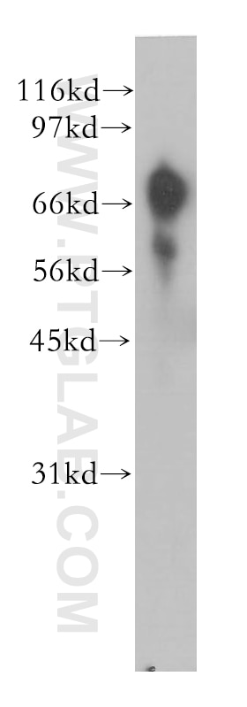 Western Blot (WB) analysis of human kidney tissue using GUCY1A3 Polyclonal antibody (12605-1-AP)