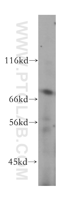 Western Blot (WB) analysis of human kidney tissue using GUCY1A3 Polyclonal antibody (12605-1-AP)