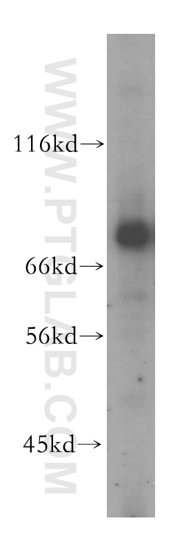 Western Blot (WB) analysis of mouse lung tissue using GUCY1A3 Polyclonal antibody (12605-1-AP)