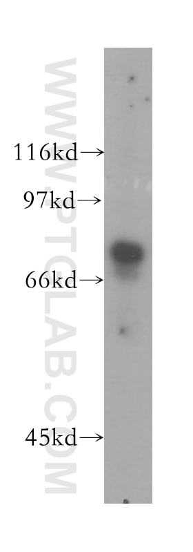 Western Blot (WB) analysis of human brain tissue using GUCY1A3 Polyclonal antibody (12605-1-AP)
