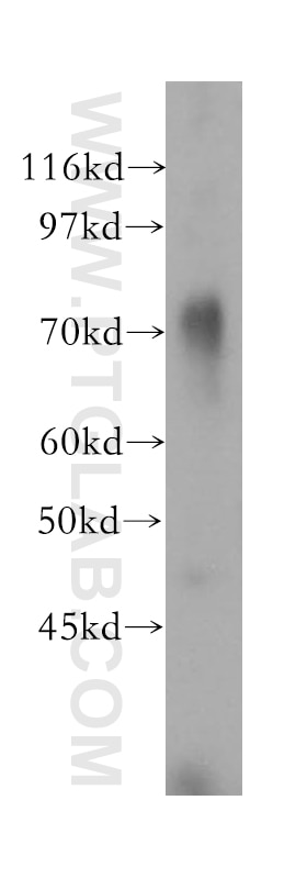 Western Blot (WB) analysis of human cerebellum tissue using GUCY1A3 Polyclonal antibody (12605-1-AP)