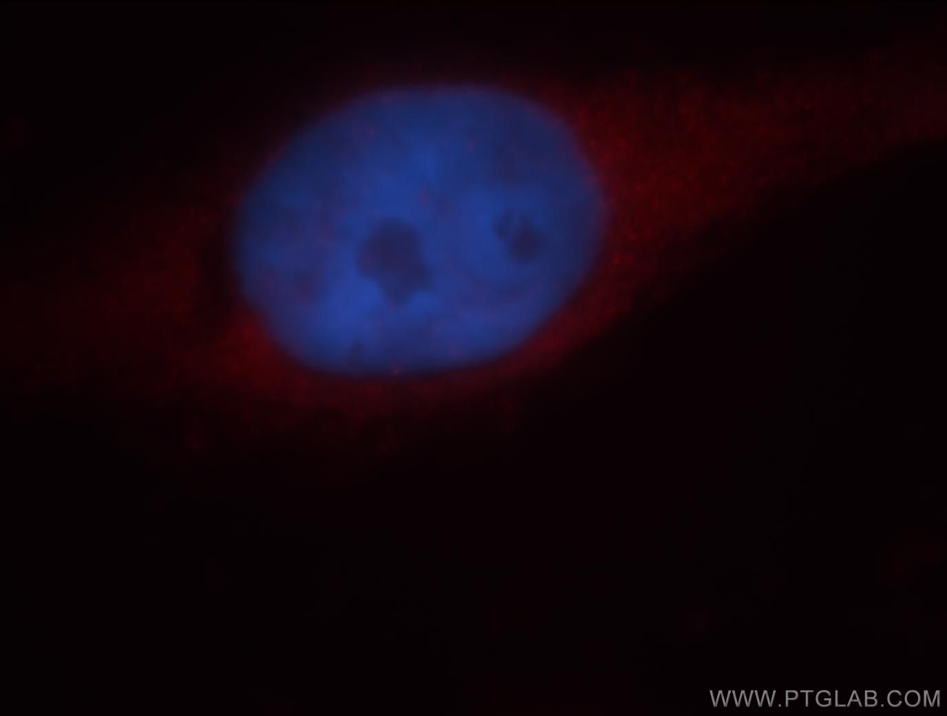 Immunofluorescence (IF) / fluorescent staining of HeLa cells using GUCY1B3 Polyclonal antibody (19011-1-AP)