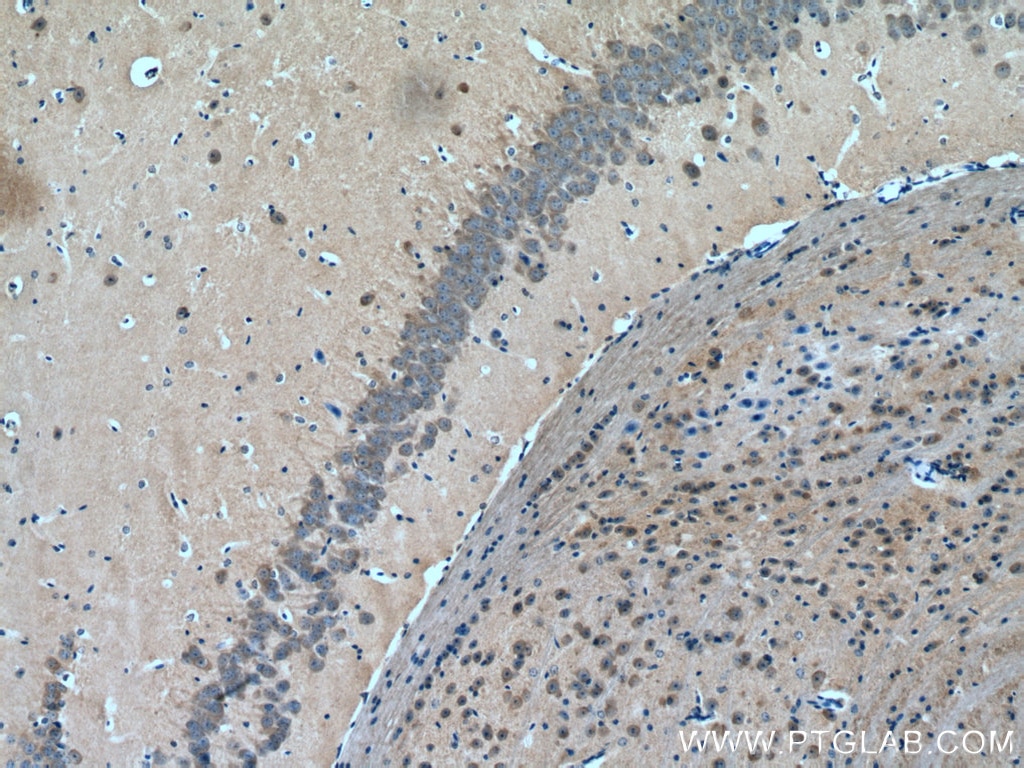 Immunohistochemistry (IHC) staining of mouse brain tissue using GUCY1B3 Polyclonal antibody (19011-1-AP)