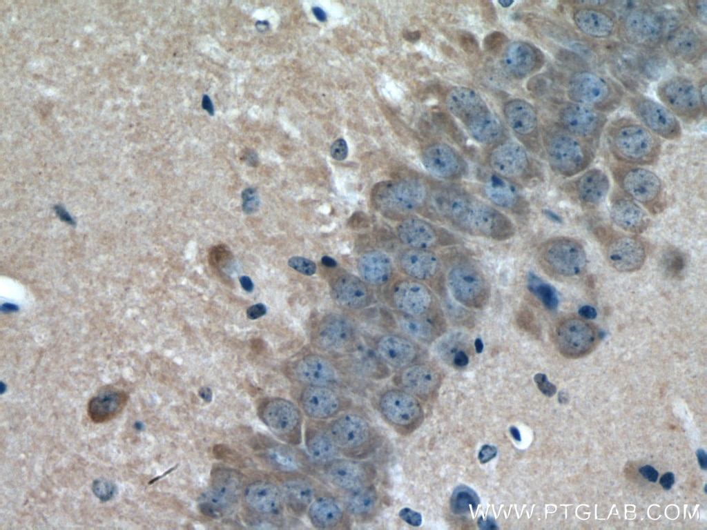 Immunohistochemistry (IHC) staining of mouse brain tissue using GUCY1B3 Polyclonal antibody (19011-1-AP)