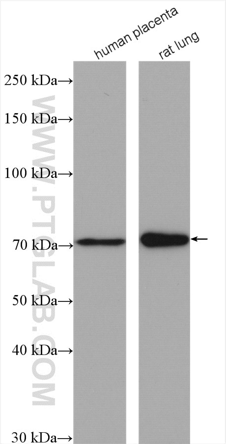 Western Blot (WB) analysis of various lysates using GUCY1B3 Polyclonal antibody (19011-1-AP)