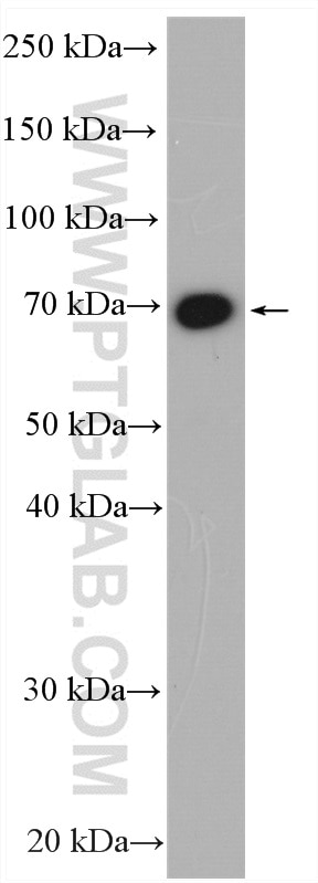 Western Blot (WB) analysis of human placenta tissue using GUCY1B3 Polyclonal antibody (19011-1-AP)