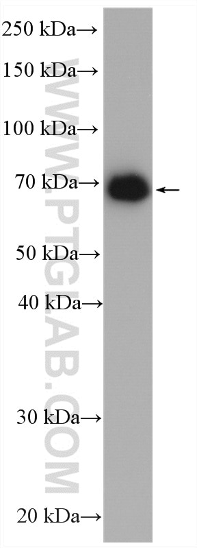 Western Blot (WB) analysis of mouse lung tissue using GUCY1B3 Polyclonal antibody (19011-1-AP)