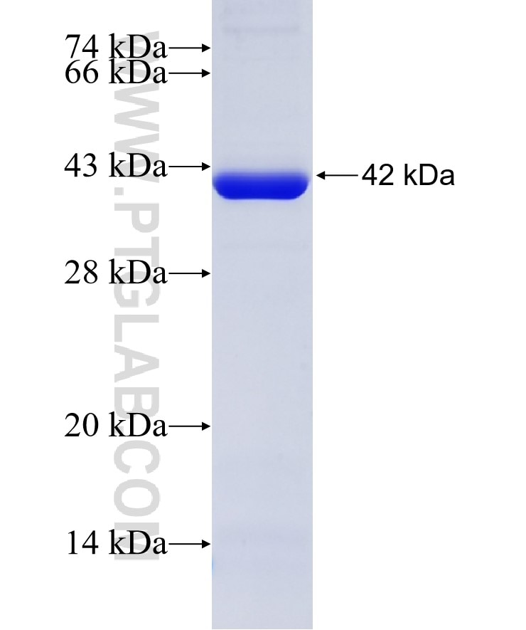 GUCY1B3 fusion protein Ag5196 SDS-PAGE