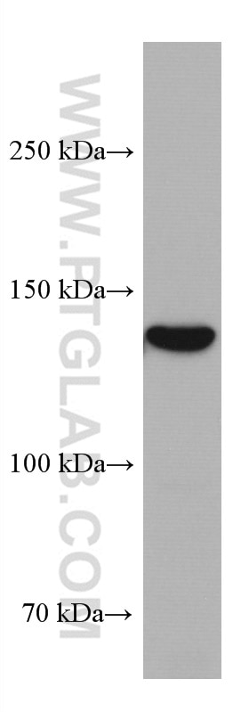 Western Blot (WB) analysis of Caco-2 cells using GUCY2C Monoclonal antibody (67782-1-Ig)