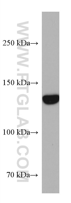 Western Blot (WB) analysis of HaCaT cells using GUCY2C Monoclonal antibody (67782-1-Ig)