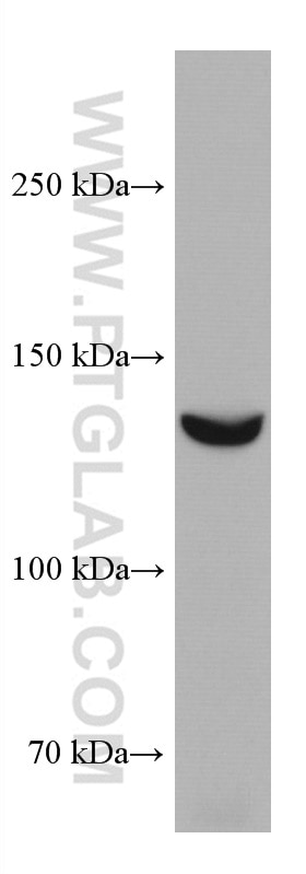 Western Blot (WB) analysis of HeLa cells using GUCY2C Monoclonal antibody (67782-1-Ig)