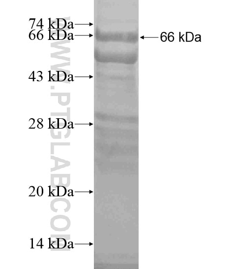 GUCY2C fusion protein Ag19207 SDS-PAGE