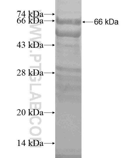 GUCY2C fusion protein Ag19207 SDS-PAGE GUCY2C fusion protein Ag19207 SDS-PAGE