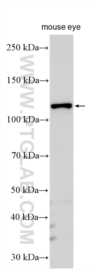 WB analysis using 55127-1-AP (same clone as 55127-1-PBS) Western Blot (WB) analysis of various lysates using GUCY2D Polyclonal antibody (55127-1-AP)