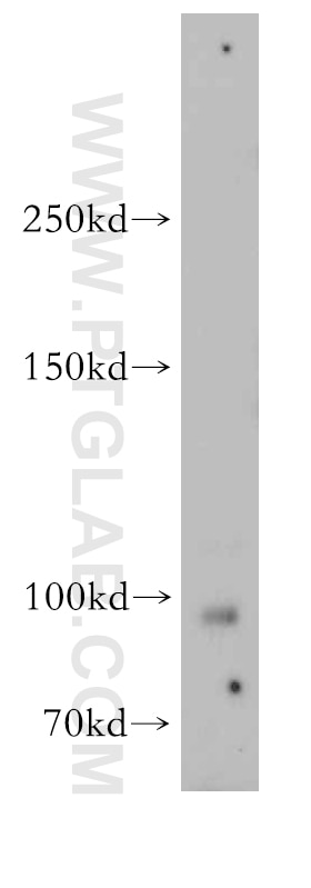 Western Blot (WB) analysis of human brain tissue using GUCY2D Polyclonal antibody (55127-1-AP)