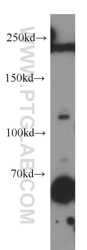 Western Blot (WB) analysis of human brain tissue using GUCY2D Polyclonal antibody (55127-1-AP)