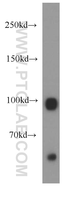 Western Blot (WB) analysis of mouse brain tissue using GUCY2D Polyclonal antibody (55127-1-AP)