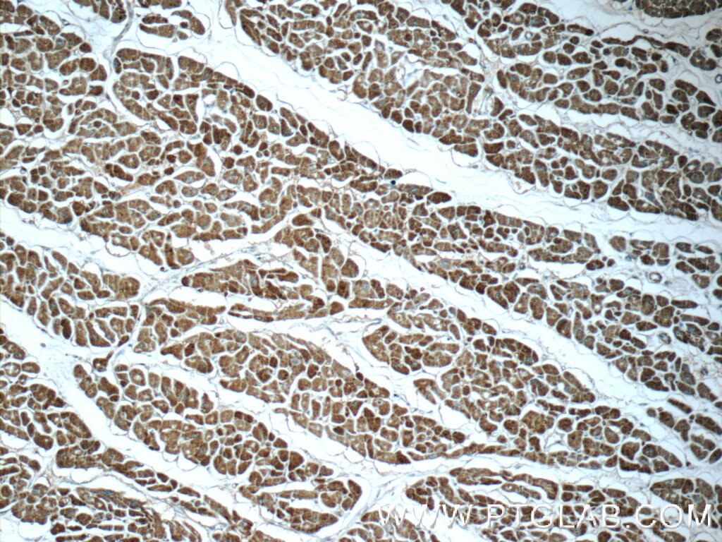 Immunohistochemistry (IHC) staining of human heart tissue using GUCY2F Polyclonal antibody (25252-1-AP)