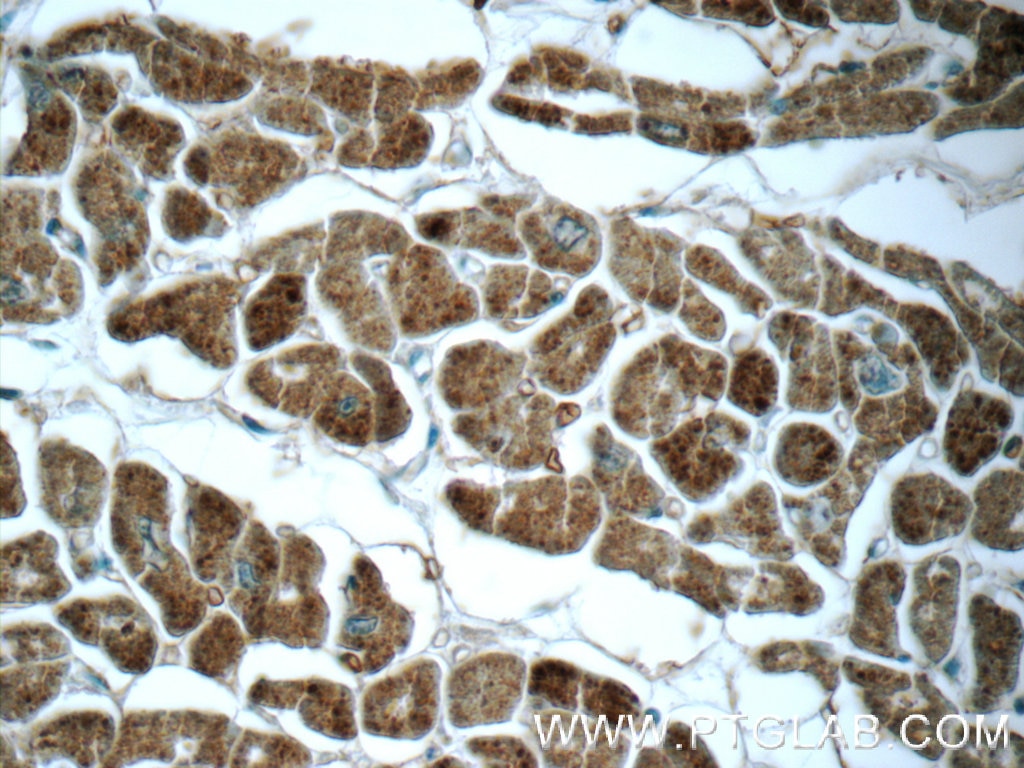 Immunohistochemistry (IHC) staining of human heart tissue using GUCY2F Polyclonal antibody (25252-1-AP)