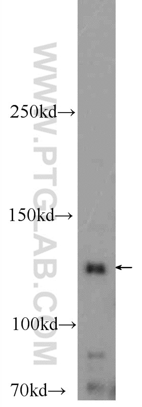 Western Blot (WB) analysis of mouse heart tissue using GUCY2F Polyclonal antibody (25252-1-AP)