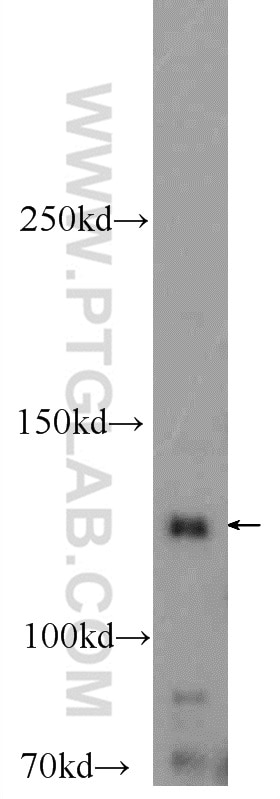 WB analysis of mouse heart using 25252-1-AP