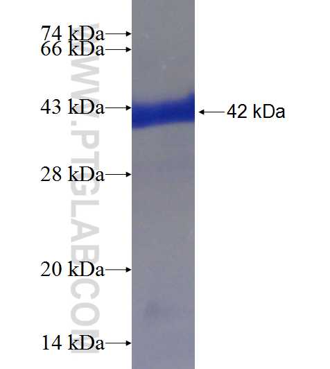 GUCY2F fusion protein Ag19266 SDS-PAGE