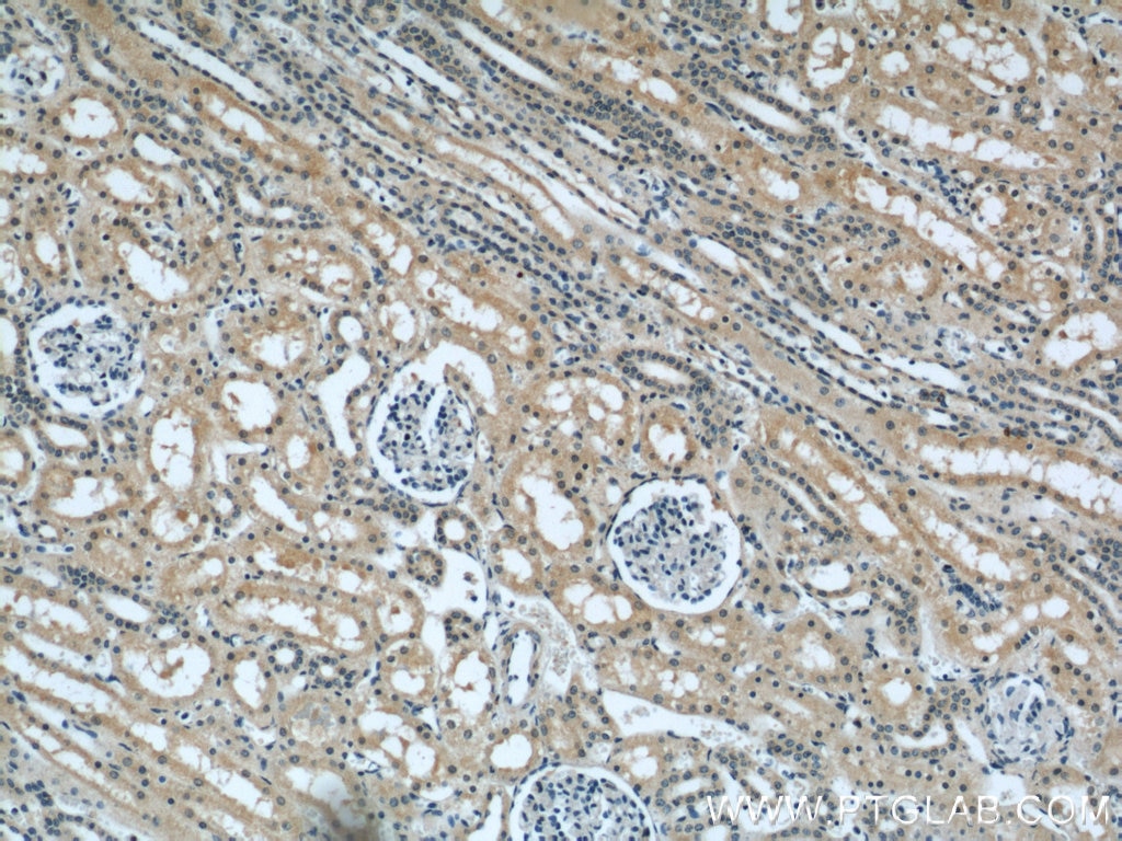 Immunohistochemistry (IHC) staining of human kidney tissue using GUF1 Polyclonal antibody (17489-1-AP)