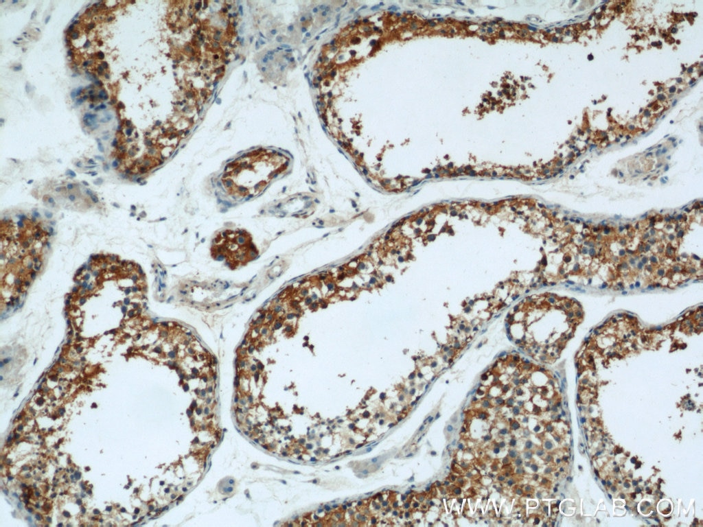Immunohistochemistry (IHC) staining of human testis tissue using GUF1 Polyclonal antibody (17489-1-AP)