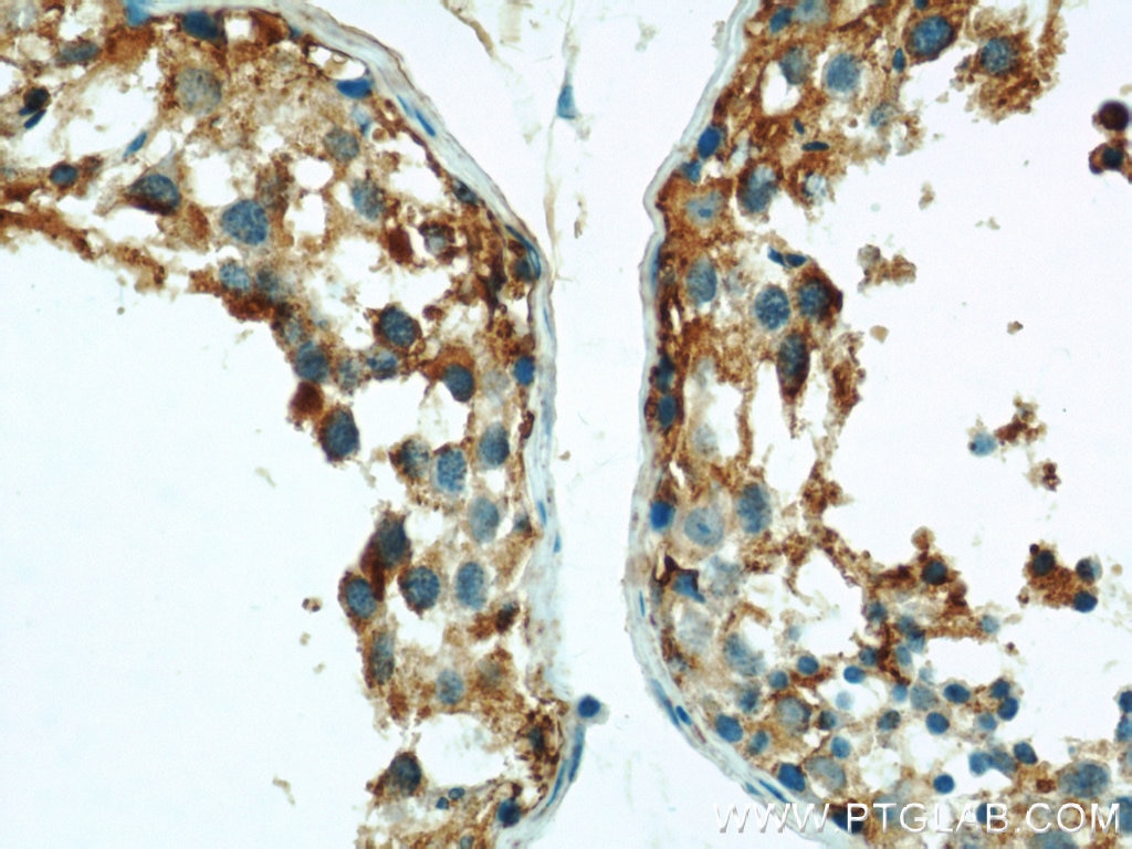 IHC staining of human testis using 17489-1-AP